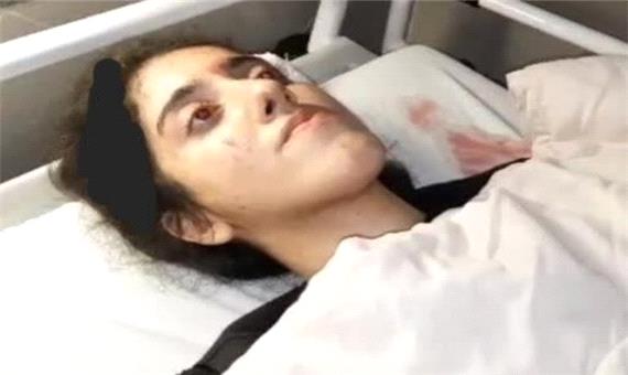 پلیس با تکذیب کشته شدن دختر 20 ساله در پیاده راه فرهنگی رشت: او از ناحیه سر دچار آسیب شده / پس از معاینات پزشکی و تهیه عکس رادیولوژی مشخص شد موضوع صدمه وارده به او چندان جدی نبوده