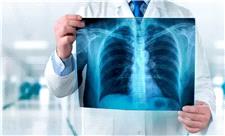 20 مورد خواندنی و شنیده نشده در مورد اشعه ایکس