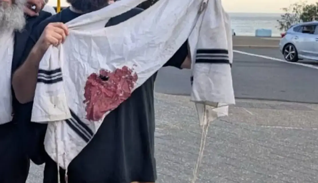 سرمقاله خراسان/ مدیریت بحران با خون دیگران