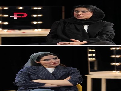 تجربه تلخ خانم بازیگر از بوتاکس زدن