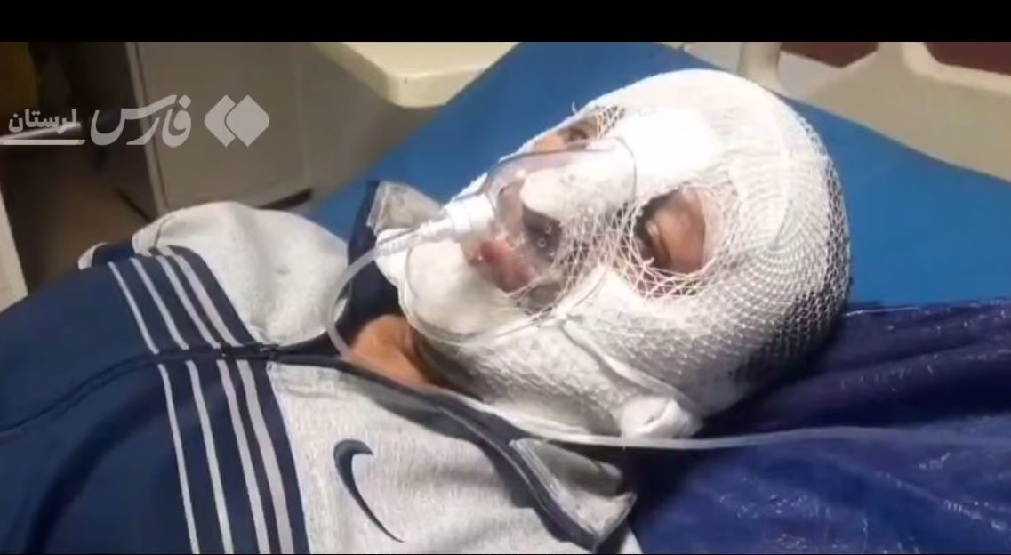 ایستادگی پلیسی که اغتشاشگران سروصورتش را به آتش کشیدند