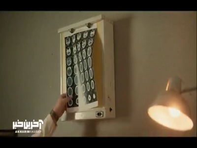 تشخیص دکتر برای بیماری یلدا درست از آب در اومد
