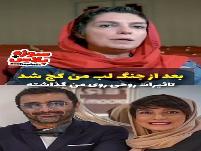 الیکا عبدالرزاقی: بعد از جنگ دهانم کج شد
