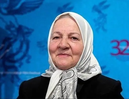 تغییر چهره چشمگیر بازیگر «وضعیت سفید» بعد از سال‌ها!